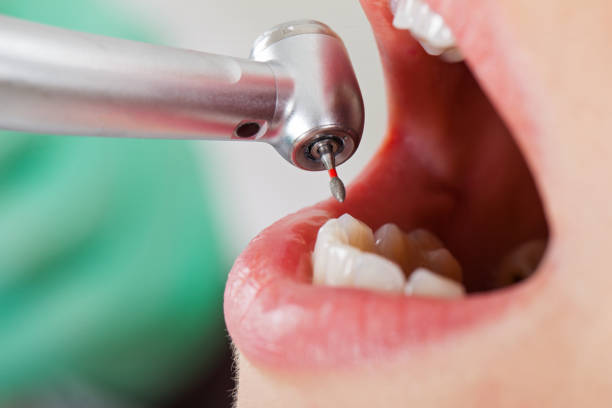 Best Holiday Emergency Dentist in Forest Ranch, CA